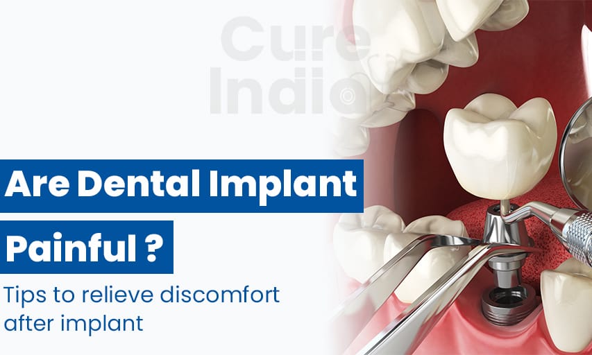 Are Dental Implants Painful-Tips to relieve discomfort after implants